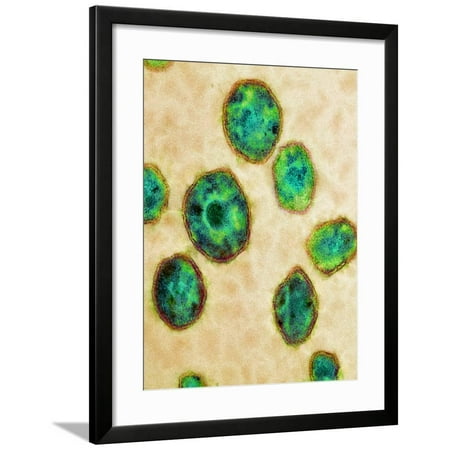 HIV Particles, TEM Framed Print Wall Art By Science Photo Library