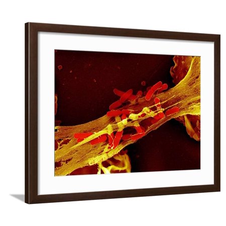 Neutrophil Cell Trapping Bacteria, SEM Framed Print Wall Art By Science Photo Library