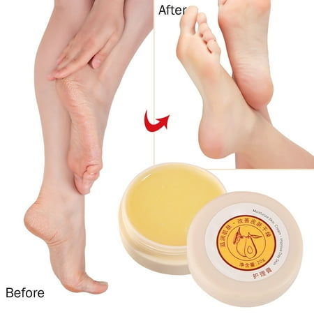 Daily Care Soothes And Softens Feet And Dry Skin Hand Care Body Care Reduces Fine And Dry Lines footcare kit for dry feet
Daily Care Soothes And Softens Feet And Dry Skin Hand Care Body Care Reduces Fine And Dry Lines footcare kit for dry feet