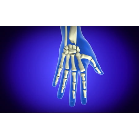 Conceptual image of bones in human hand Stretched Canvas - Stocktrek Images (36 x 23)