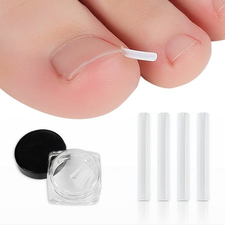 Toyella Filler Nail Pad Plaster Nail Silk Brace White 20PCs C Slot