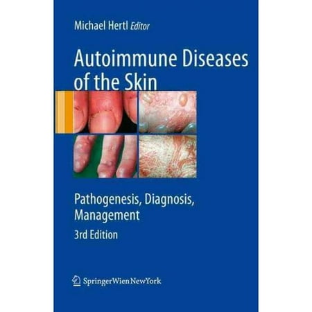 Psoriasis and Other Autoimmune Diseases: Are You at Risk foto images Psoriasis and Other Autoimmune Diseases: Are You at Risk