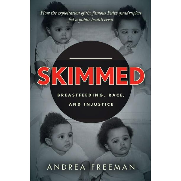 Skimmed: Breastfeeding, Race, and Injustice (Hardcover)