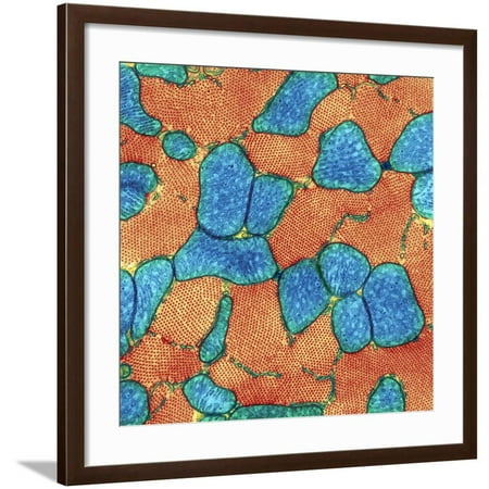 Cardiac Muscle, TEM Framed Print Wall Art By Thomas Deerinck