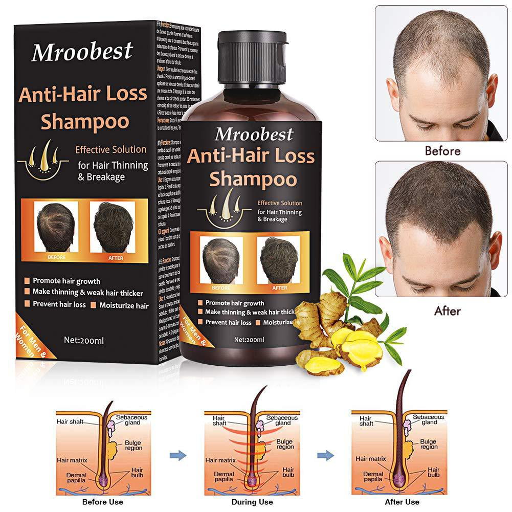 Anti Hair Loss Shampoo Hair Regrowth Shampoo Natural Old Ginger Hair
