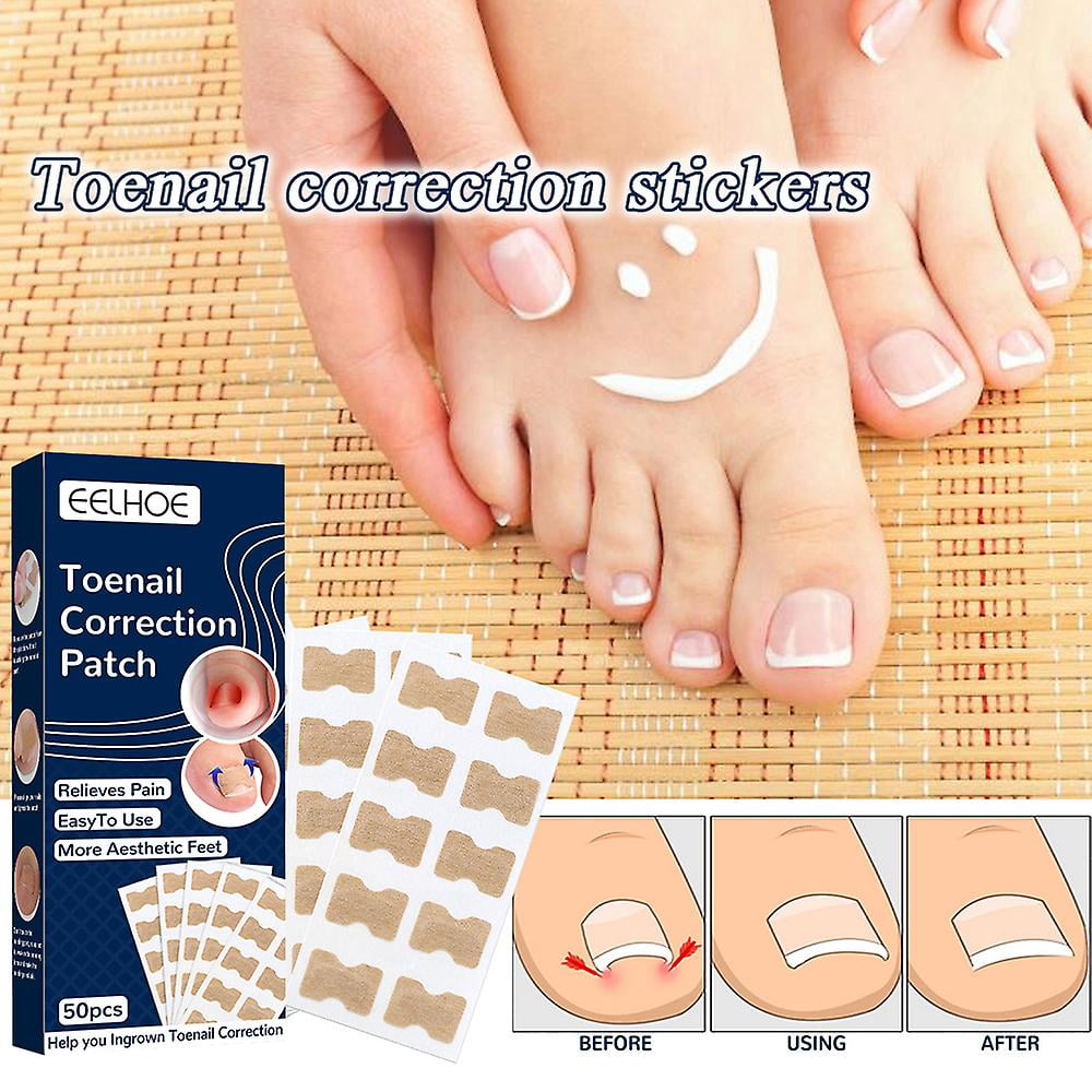 50 Pcs Ingrown Toenail Correction Sticker Elastic Toenail Pedicure