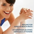 thumbnail image 3 of Vaseline Body Balm Stick For Dry Skin Relief Unscented Targeted Healing For Hard-To-Reach Spots 1.4 Oz, 3 of 3