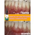 thumbnail image 4 of Repair gums, no more worries, 4 of 5