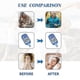 thumbnail image 5 of S-Ring Diabetes Glucose Monitoring Band Y for Continuous Blood Sugar Tracking, 5 of 5
