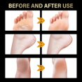thumbnail image 3 of Jaysuing 2 Pairs Lavender Exfoliating Foot Mask Moisturizing Hydrating Remove Dead Skin Foot Pad |, 3 of 4