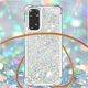 thumbnail image 5 of Funda FOXDOCK para Xiaomi Redmi Note 11/11s 4G con Cuerda Ajustable, Brillo Líquido, Protección Antigolpes y Lente – Ideal para Regalo, 5 of 6