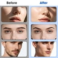 thumbnail image 4 of EXLEAF 2026 New Sonic Dermaplaning Razor with Led Light, Women'S Facial Hair Remover, Facial Fuzz Remover, 6 Replacement Heads&3 Speeds, 4 of 7