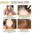 thumbnail image 2 of Natural Vegan Hair Growth Oil,vegan Hair Growth Oil With Root Comb Applicator Bottle,vegan Hair Oil For Dry Damaged Hair,rosemary Oil For Thin Hair, 2 of 5