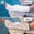 thumbnail image 7 of COEQINE Hummingbird Flower Leg Cast Cover 2 Pcs Stretch Fabric Leg Cast Protector Decorative Leg Cast Cover Leg Plaster Sleeve Easy to Put on Leg Cast Cover for Showering for Teen Size M, 7 of 7