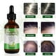 thumbnail image 2 of Aceite de romero ALIVER para el crecimiento del cabello y el cuidado de la piel 120 ml, 2 of 6