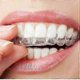 thumbnail image 1 of 12pcs Silicone Mouth Guard Night Teeth Clenching Grinding Sleep Dental Tool, 1 of 5