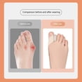 thumbnail image 1 of Unisex Hallux Valgus aparato elástico Hallux Valgus órtesis para pie suministros, 1 of 9