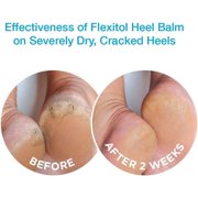 Flexitol Heel Balm 4 Oz Tube (Pack of 2), Rich Moisturizing & Exfoliating Foot Cream. Fast Relief of Rough, Dry & Cracked Skin on Heels/Feet. For Daily Use and Pedicures. Diabetic Safe and Effective