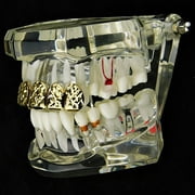 14k Gold Plated Grillz Diamond-Cut Bling Grill Top Upper Six 6 Teeth Hip Hop Mouth Grills