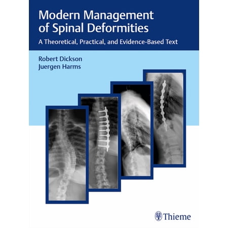 Modern Management of Spinal Deformities: A Theoretical Practical and Evidence-Based Text (Hardcover)
