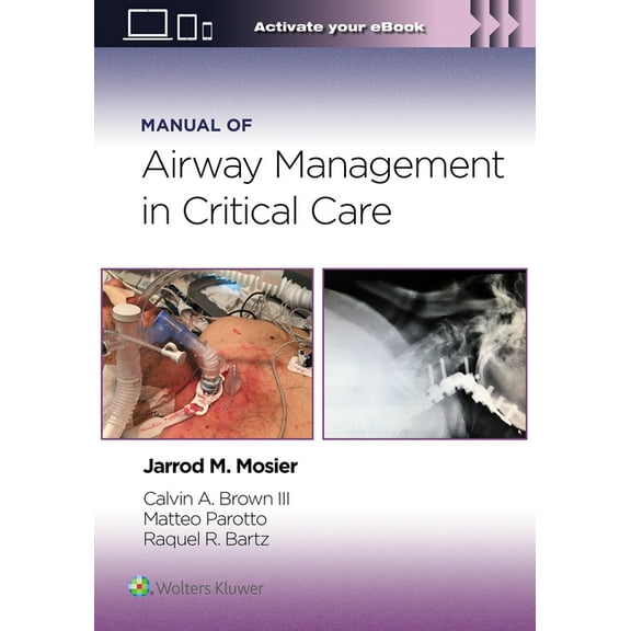 Manual of Airway Management in Critical Care: Print eBook with Multimedia, (Paperback)