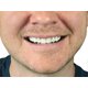 thumbnail image 2 of Veneer cosmetic teeth white teeth cover silicone simulation upper dentures simulation dentures plastic dentures, 2 of 4
