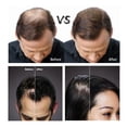 thumbnail image 5 of FIBR Hair Keratin Building Fibers, Fill In Fine and Thinning Hair for instant Full and Thick Look, Premium Hair Fibers For Both Men and Women (Blonde), 5 of 7