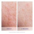 thumbnail image 3 of iS CLINICAL Active Serum, 0.5 fl. oz., 3 of 6
