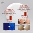 thumbnail image 2 of Mascarilla facial CANDORLOV Collagen Lifting Peel Off 70 ml, 2 of 6
