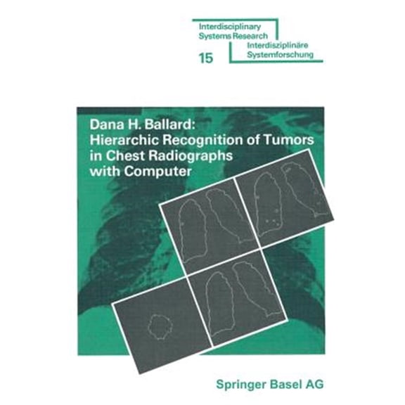 Pre-Owned Interdisciplinary Systems Research Hierarchic Recognition of Tumors in Chest Radiographs with Computer, (Paperback)