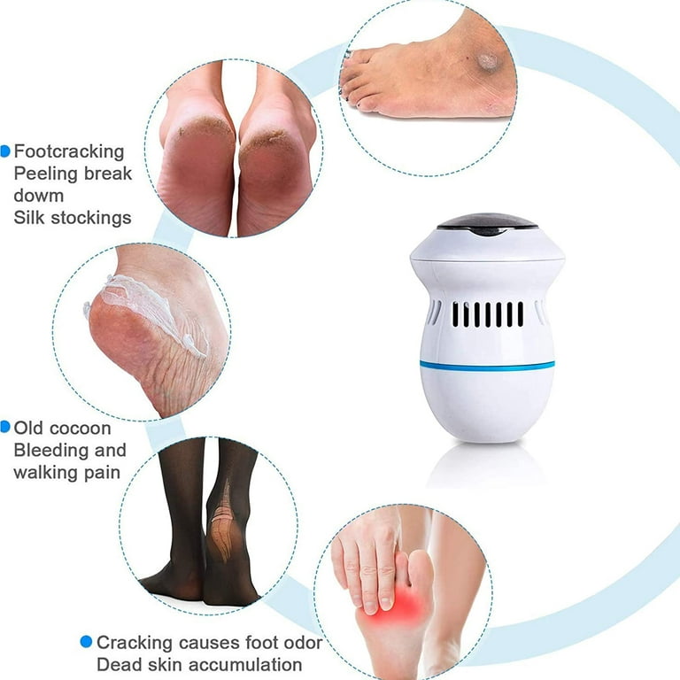 Electric Callus Remover for feet, Rechargeable Foot File Hard Skin