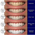 thumbnail image 4 of Of Whitening Teeth Remove Stain White Teeth Brighten Tartar Stains Tobacco Tooth Clean Brightening Care, 4 of 5