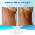 thumbnail image 5 of Paquete combinado de crema de manos Glysomed (2 x crema de manos Glysomed, tubo grande de 250 ml / 8,5 fl oz), 5 of 5