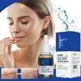 Shark Scar Repair Water Scar Liquid 30ml Remove Scar Repair Moisturizing Oil 3PCS Ordinary Skin