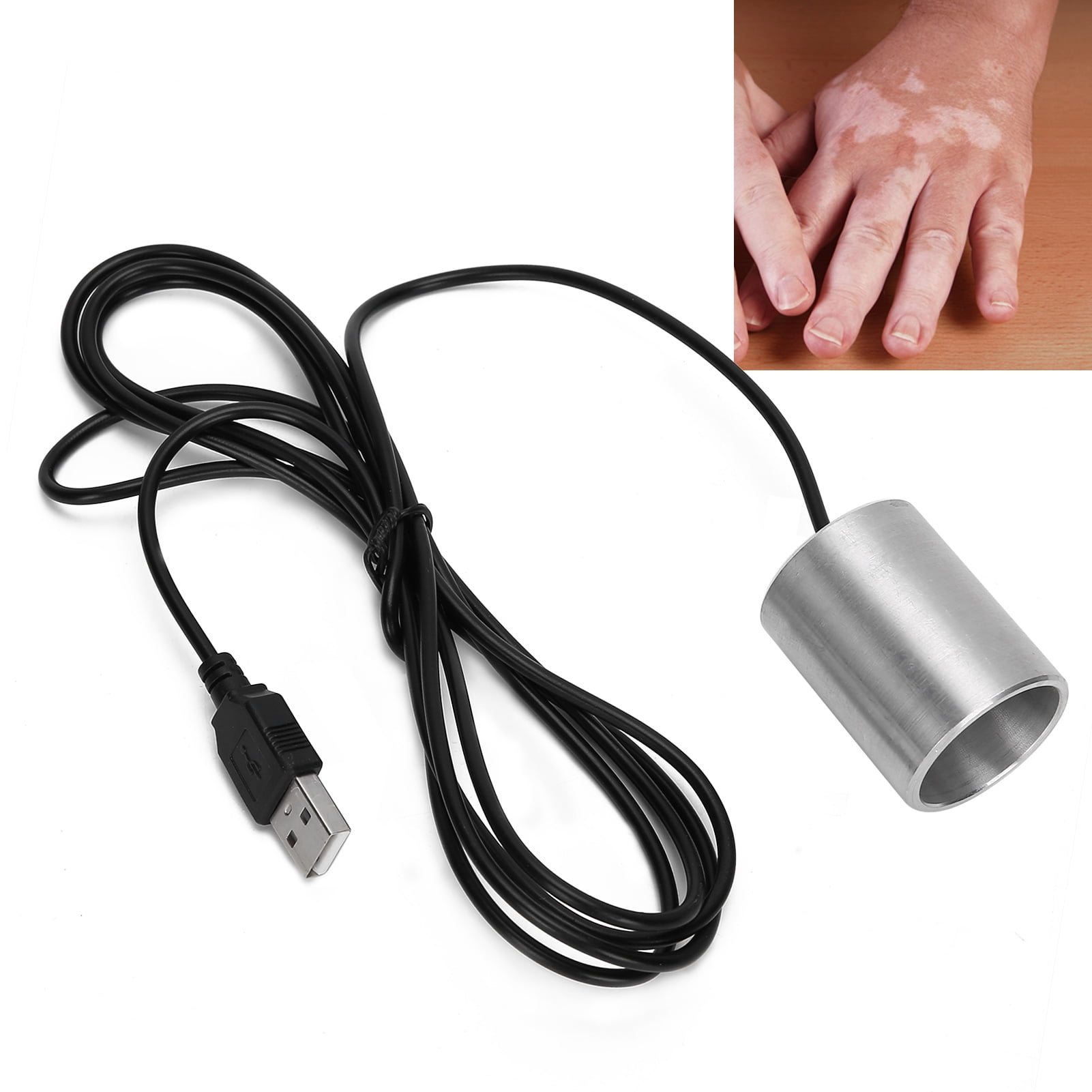 Buy Dioche Vitiligo Physiotherapy Instrument Psoriasis Therapy Device