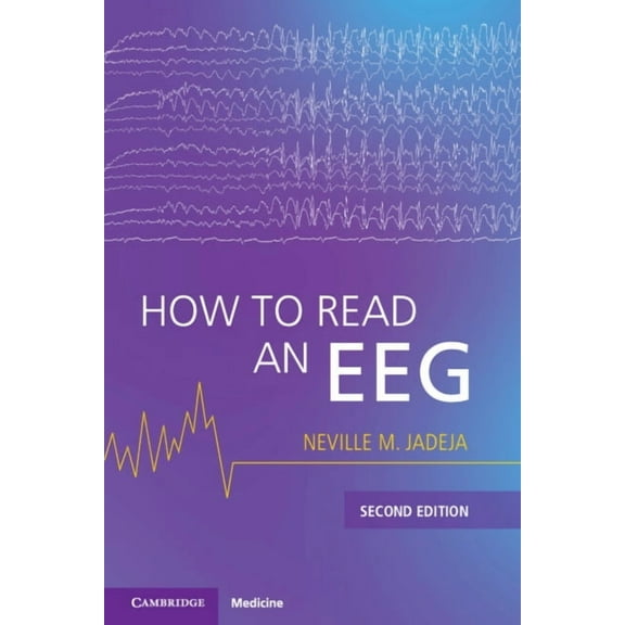 How to Read an Eeg, (Paperback)