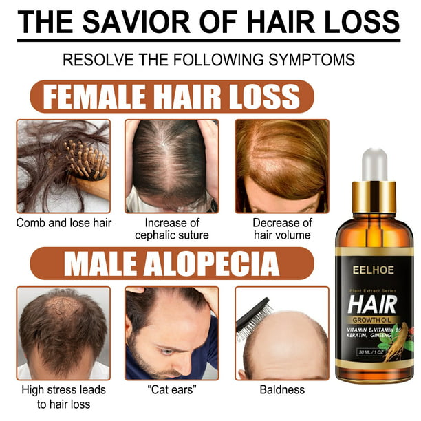 Elecsop 2PCS Hair Growth Oil, Biotin Hair Growth Serum Hair Loss Treatment  for Thicker Longer Healthier Hair, Promotes Hair Regrowth, Prevent Thinning  Hair 