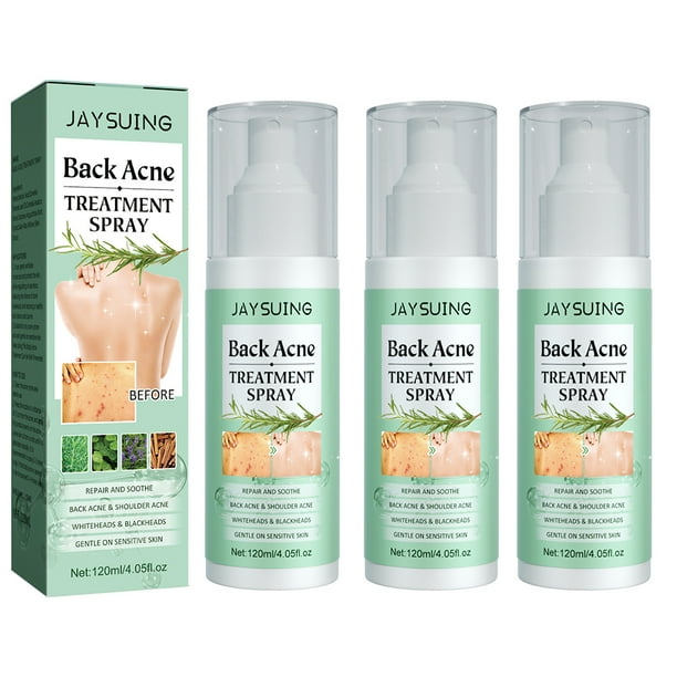 HFDHD MEDix Back Acne Treatment Spray, 120ml Back Acne Treatment Spray