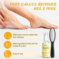 thumbnail image 3 of Kit de pedicura POP MODERN.C, juego de spa para pies de 5 piezas con sal para remojar los pies, 3 of 6