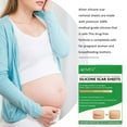 thumbnail image 3 of Aliver 4Pcs Silicone Scar Sheets Scar Tape, 2 Months Supply Professional Scar Removal Strips, 3 of 7