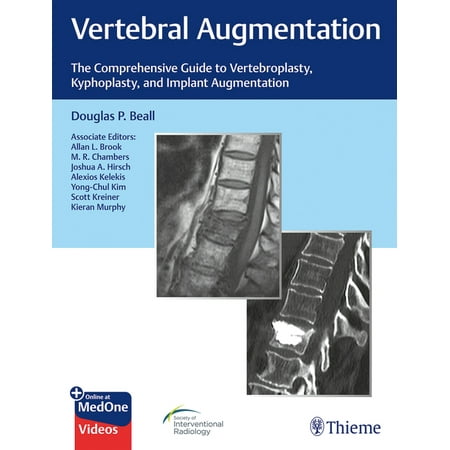 UPC: 9781684200153 | Vertebral Augmentation: The Comprehensive Guide to Vertebroplasty  Kyphoplasty  and Implant Augmentation (Hardcover)