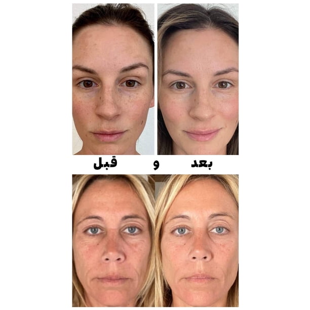 neumi glutathione spray Neumi Skin 3.4 FL OZ Facial Spray (Nano-Formulated) with Glutathione,  Collagen, and Hyaluronic Acid, Face Care & Firm, Pore Minimizer Face Spray,  Reduce Fine Lines and Wrinkles, (1 Pac