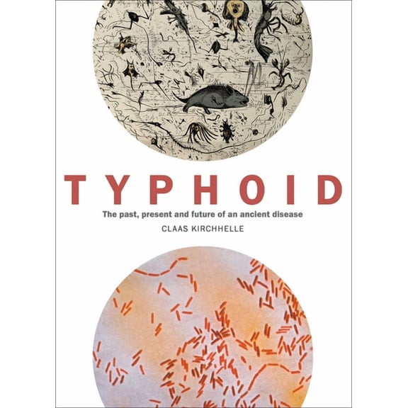 Typhoid : The past, present, and future of an ancient disease (Paperback)