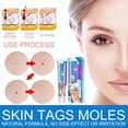 thumbnail image 4 of Crema para eliminar verrugas para el cuidado de la piel, para rostro y cuerpo, eficaz eliminador de verrugas y tratamiento de manchas, 4 of 10
