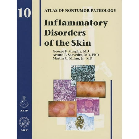 UPC: 9781933477244 | Pre-Owned Inflammatory Disorders of the Skin (Hardcover) 9781933477244