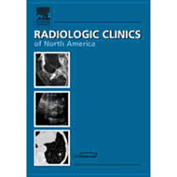The Clinics: Radiology, Volume 43-3: Essentials of Thoracic Imaging, an Issue of Radiologic Clinics, Volume 43-3 (Hardcover)