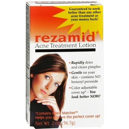 Rezamid Acne Treatment Lotion 2 oz (Best Treatment For Forehead Acne)
