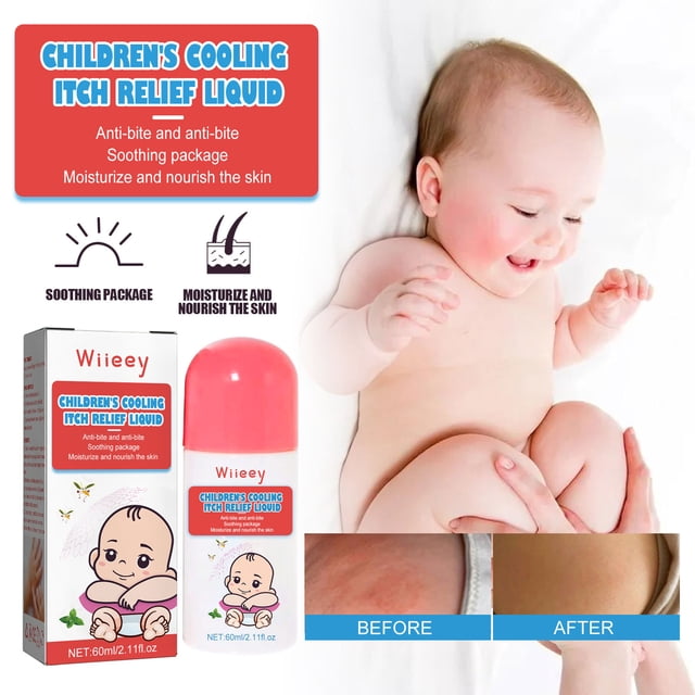Gel para aliviar la picazón Fiudx Crema para niños y adultos Picaduras de mosquitos 60 ml