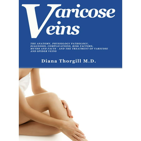 Varicose Veins: The Anatomy, Physiology Pathology, Diagnosis, Complications, Risk Factors, Myths and Facts and the Treatment of Varicose and Spider Veins - (Best Treatment For Broken Veins On Face)