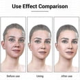 thumbnail image 4 of 7 Colors Led Light Therapy Mask, Red & Blue Light Therapy For Face, Light Mask For Skin Care, Portable Rechargeable Safety Automatic-timer Control, 4 of 4
